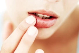 6 dấu hiệu khắp cơ thể báo động stress