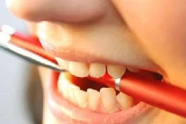 Làm thế nào để hạn chế tật nghiến răng khi ngủ?