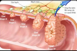 Những bệnh không nên dùng vitamin