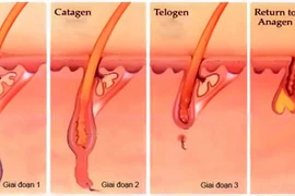 Thuốc nào trị viêm chân tóc?