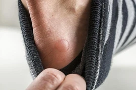 Năm dấu hiệu bạn đang đi giày sai cách