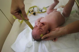 Virus Zika được cảnh báo nguy hiểm hơn mọi người nghĩ