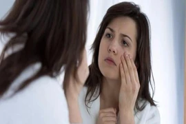 6 lý do làm bạn bị sưng bọng mắt