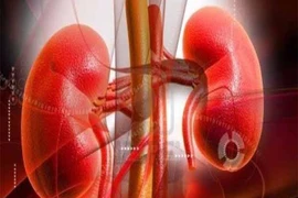 Hai quả thận của bạn làm việc vất vả như thế nào