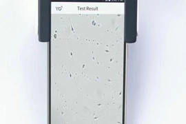 Tự kiểm tra chất lượng tinh trùng bằng smartphone