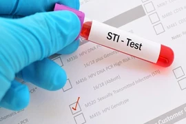 Bệnh hiếm vùng kín tưởng bị lãng quên bắt đầu trở lại