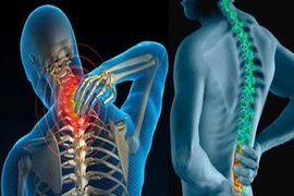 Hướng dẫn tư thế đúng cho người bị bệnh cột sống