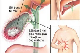 (Hình minh họa)