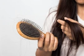 Hậu COVID-19 tóc rụng cả nắm, bác sĩ chỉ cách giúp tóc 'quay lại'