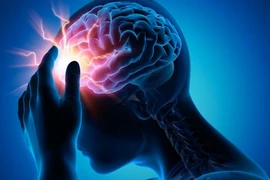 Phình động mạch não nguy hiểm thế nào?