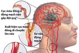 Hình minh họa