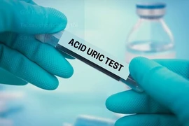 Nồng độ acid uric trong máu bao nhiêu là bình thường?