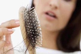 Những điều cần biết trước khi điều trị rụng tóc