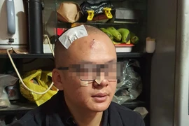 Bị đánh vì lên facebook chê khu du lịch