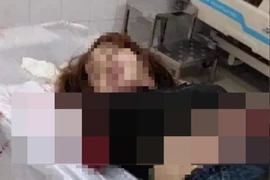 Chém đứt lìa 2 cánh tay của vợ vì ghen tuông