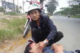  Vụ cô gái bị tai nạn không ai cứu: Tôi đau lắm!
