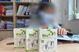 Nha khoa cấy nhầm trụ răng cho khách hàng