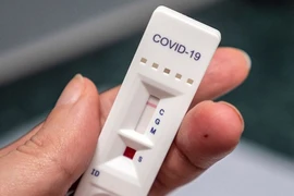 Mòn mỏi chờ bình ổn giá kit xét nghiệm 