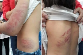 Bắt giam người cha đánh đập con gái 9 tuổi