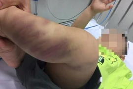 Khởi tố vụ bé trai 1 tuổi bị bạo hành dã man ở Hà Nội