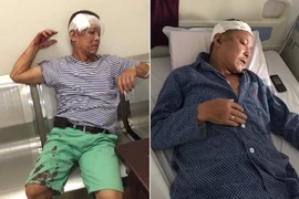 Xông vào trụ sở công an phường đánh người