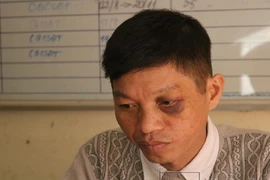 1 CSGT bị người vi phạm tông xe, tấn công