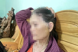 Phẫu thuật thẩm mỹ trái phép khiến 1 phụ nữ nhập viện cấp cứu 