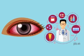5 thắc mắc thường gặp khi bị đau mắt đỏ