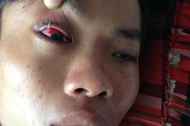 Công an xã bị tố đánh người dập lá lách