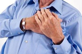 Chớ nhầm lẫn giữa đột quỵ và đau tim