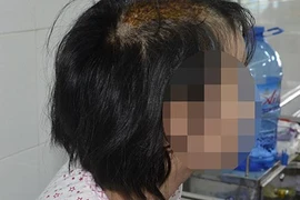 Đòi công lý và an toàn cho cháu bị chém