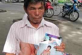 Nghi trộm, một người bị công an đánh
