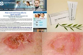 Chỉ xoa kem là hết ung thư vú (?!)
