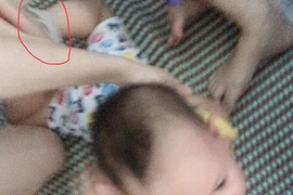 Ba cô giáo trói, đánh, nhét giẻ vào mồm trẻ