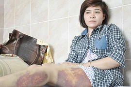 Đánh nghi can để truy xét vụ trộm điện thoại