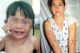 Khống chế người tình, đe dọa ném chất nổ