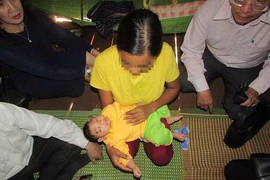 Ca bệnh đầu tiên nghi do virus Zika 