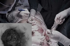 Phẫu thuật thẩm mỹ dỏm tung hoành làng quê
