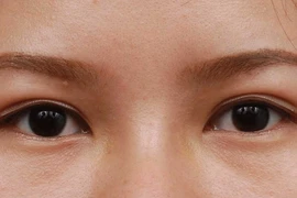 Đủ thứ mối nguy khi mắt ‘biểu tình’