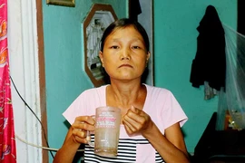 Chuyện lạ: Người ăn 5 lon gạo/ngày, chỉ nặng 26 ký