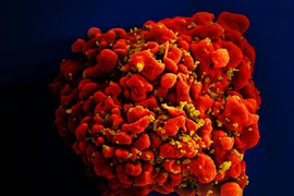 Em bé thứ ba trên thế giới được chữa khỏi HIV