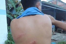 Đòi nợ kiểu xã hội đen lan đến thôn quê
