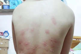 Lấy mẫu truy nguyên nhân ngứa khi tắm biển Đà Nẵng