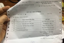 Thú cưng gây bệnh nguy hiểm không ngờ