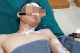 Cấp cứu ngộ độc rượu, pháo tăng chóng mặt