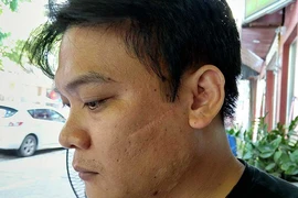 Nghi án lọt người, lọt tội ở Hải Phòng