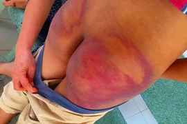 ‘Nhà tu hành’ đánh dã man trẻ tu tập