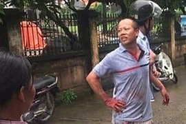 Sau truy sát gia đình em trai, nghi can tự tử bất thành