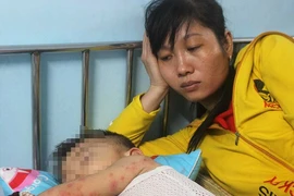 Bệnh tay-chân-miệng vào mùa