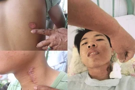 Nam thanh niên tố bị CSGT bắn gây thương tích